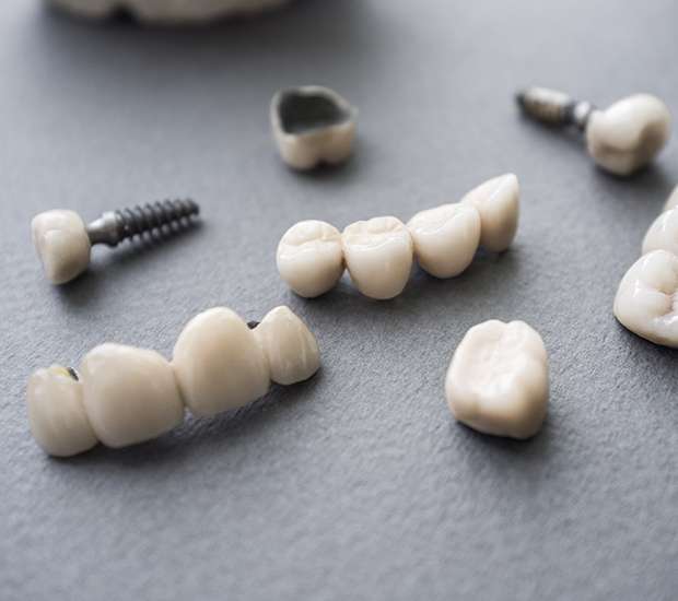 Hallandale Beach The Difference Between Dental Implants and Mini Dental Implants