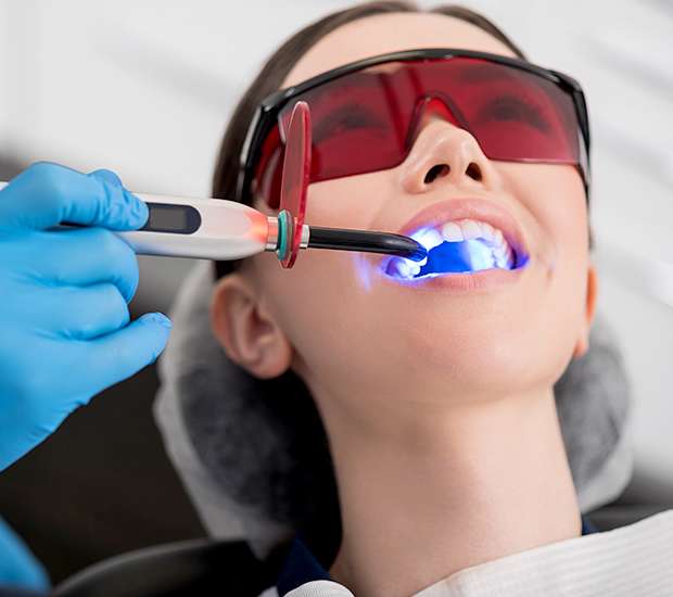 Hallandale Beach Professional Teeth Whitening